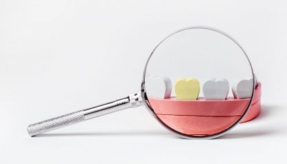 Dlaczego zęby ciemnieją i jak temu zapobiegać?