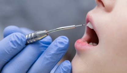 Laser w stomatologii – co warto wiedzieć?